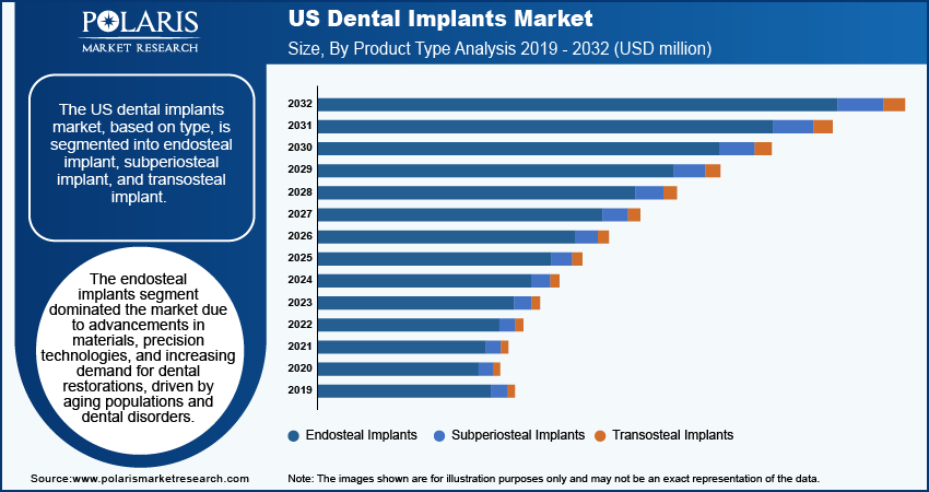 U.S. Dental Implants Market Size